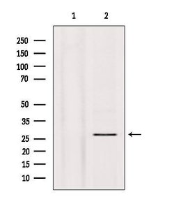 Phospho-p27 Kip1 (Thr157) Polyclonal Antibody:Antibodies, Polyclonal