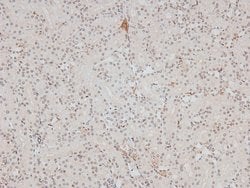 Phospho-p27 Kip1 (Ser178) Polyclonal Antibody:Antibodies, Polyclonal