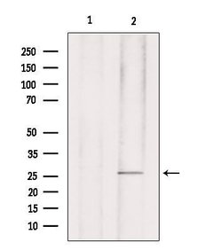 Phospho-p27 Kip1 (Ser178) Polyclonal Antibody:Antibodies, Polyclonal