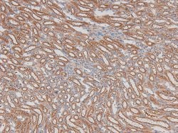 Invitrogen Phospho-ILK (Ser343) Polyclonal Antibody 100 &mu;L; Unconjugated:Antibodies,