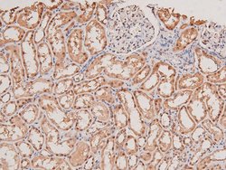 Invitrogen Phospho-STK38/STK38L (Thr444, Thr442) Polyclonal Antibody 100