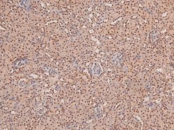 Invitrogen Phospho-STK38/STK38L (Thr444, Thr442) Polyclonal Antibody 100