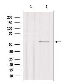 Invitrogen Phospho-STK38/STK38L (Thr444, Thr442) Polyclonal Antibody 100