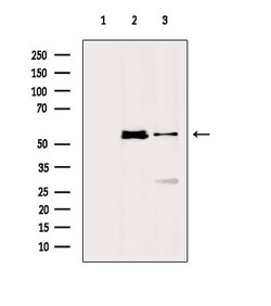 Invitrogen Phospho-STK38/STK38L (Thr444, Thr442) Polyclonal Antibody 100