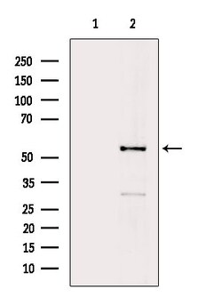 Invitrogen Phospho-STK38/STK38L (Thr444, Thr442) Polyclonal Antibody 100