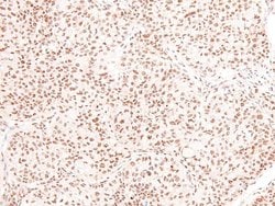 Invitrogen Phospho-PKC theta (Tyr90) Polyclonal Antibody 100 &mu;L; Unconjugated:Antibodies,