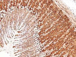 Invitrogen Phospho-PKC theta (Tyr90) Polyclonal Antibody 100 &mu;L; Unconjugated:Antibodies,