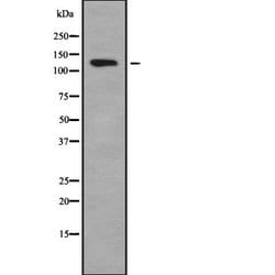 Invitrogen ADCY1 Polyclonal Antibody 100 &mu;L | Buy Online | Invitrogen&trade; | Fisher Scientific
