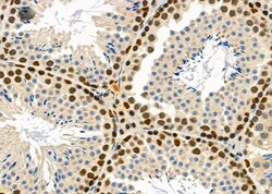 Invitrogen Ubiquilin 4 Polyclonal Antibody 100 &mu;L; Unconjugated:Antibodies,