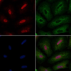 Invitrogen v-Myb Polyclonal Antibody 100 &mu;L; Unconjugated:Antibodies,