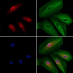 Invitrogen v-Myb Polyclonal Antibody 100 &mu;L; Unconjugated:Antibodies,
