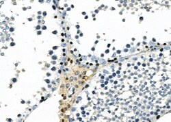 Invitrogen A20A3 Polyclonal Antibody 100 &mu;L | Buy Online | Invitrogen&trade; | Fisher Scientific