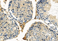 Invitrogen APOOL Polyclonal Antibody 100 &mu;L | Buy Online | Invitrogen&trade; | Fisher Scientific