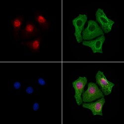 Invitrogen NR2F2 Polyclonal Antibody 100 &mu;L; Unconjugated:Antibodies,