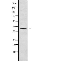 Invitrogen NR2F2 Polyclonal Antibody 100 &mu;L; Unconjugated:Antibodies,