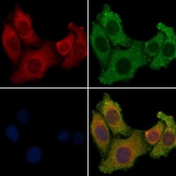 Invitrogen ARRDC2 Polyclonal Antibody 100 &mu;L | Buy Online | Invitrogen&trade; | Fisher Scientific