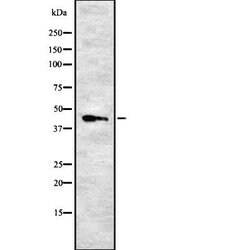 Invitrogen ARRDC2 Polyclonal Antibody 100 &mu;L | Buy Online | Invitrogen&trade; | Fisher Scientific