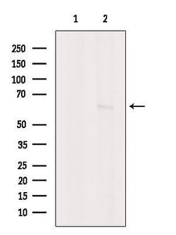 Invitrogen CaMKII beta/gamma Polyclonal Antibody 100 &mu;L; Unconjugated:Antibodies,