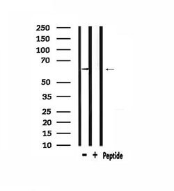 Invitrogen CaMKII beta/gamma Polyclonal Antibody 100 &mu;L; Unconjugated:Antibodies,