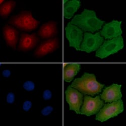 Invitrogen PNCK Polyclonal Antibody 100 &mu;L; Unconjugated:Antibodies,