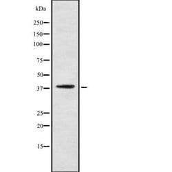 Invitrogen PNCK Polyclonal Antibody 100 &mu;L; Unconjugated:Antibodies,