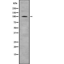 Invitrogen alpha E-Catenin/alpha N-Catenin Polyclonal Antibody 100 &mu;L;