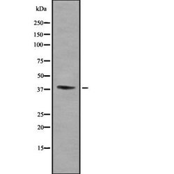 Invitrogen KIR2DL5B Polyclonal Antibody 100 &mu;L; Unconjugated:Antibodies,