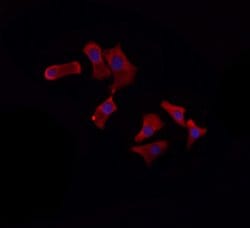 Invitrogen APC6 Polyclonal Antibody 100 &mu;L; Unconjugated:Antibodies,