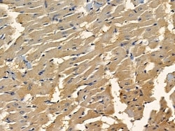 Invitrogen CEP152 Polyclonal Antibody 100 &mu;L; Unconjugated:Antibodies,