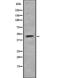 Invitrogen CNOT2 Polyclonal Antibody 100 &mu;L | Buy Online | Invitrogen&trade; | Fisher Scientific