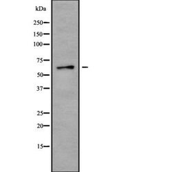 Invitrogen CPNE8 Polyclonal Antibody 100 &mu;L | Buy Online | Invitrogen&trade; | Fisher Scientific
