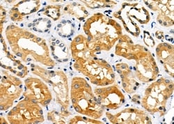 Invitrogen COX7A2/COX7A3 Polyclonal Antibody 100 &mu;L; Unconjugated:Antibodies,