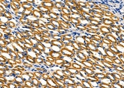 Invitrogen COX7A2/COX7A3 Polyclonal Antibody 100 &mu;L; Unconjugated:Antibodies,