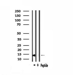 Invitrogen COX7A2/COX7A3 Polyclonal Antibody 100 &mu;L; Unconjugated:Antibodies,