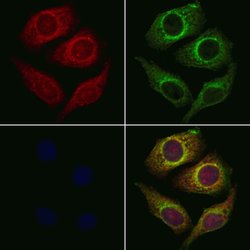 Invitrogen CYB561D1 Polyclonal Antibody 100 &mu;L; Unconjugated:Antibodies,
