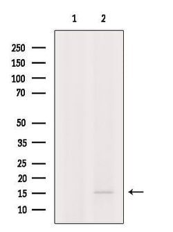 Invitrogen CYB561D1 Polyclonal Antibody 100 &mu;L; Unconjugated:Antibodies,