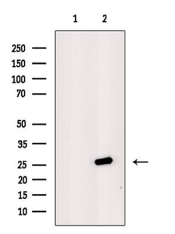 Invitrogen DCL-1 Polyclonal Antibody 100 &mu;L; Unconjugated:Antibodies,