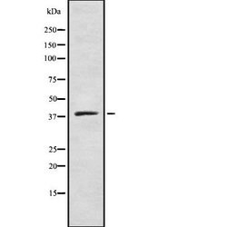 Invitrogen ZDHHC9 Polyclonal Antibody 100 &mu;L; Unconjugated:Antibodies,