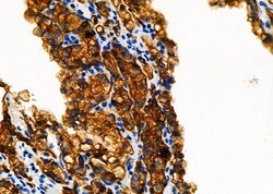 Invitrogen DNAI1 Polyclonal Antibody 100 &mu;L; Unconjugated:Antibodies,