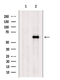 Invitrogen Ephrin B3 Polyclonal Antibody 100 &mu;L | Buy Online | Invitrogen&trade; | Fisher Scientific