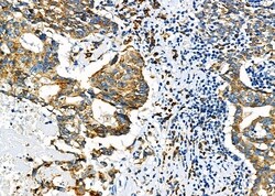 Invitrogen GSPT1 Polyclonal Antibody 100 &mu;L; Unconjugated:Antibodies,