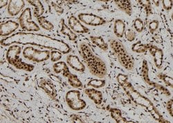 Invitrogen FOXR1 Polyclonal Antibody 100 &mu;L; Unconjugated:Antibodies,