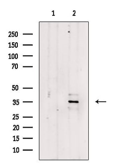 Invitrogen FOXR1 Polyclonal Antibody 100 &mu;L; Unconjugated:Antibodies,