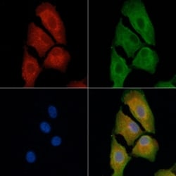 PMP22 Polyclonal Antibody:Antibodies, Polyclonal