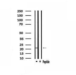 PMP22 Polyclonal Antibody:Antibodies, Polyclonal