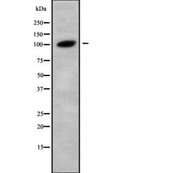 Invitrogen GANAB Polyclonal Antibody 100 &mu;L | Buy Online | Invitrogen&trade; | Fisher Scientific