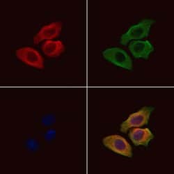 Invitrogen GPRC5C Polyclonal Antibody 100 &mu;L; Unconjugated:Antibodies,