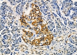 Invitrogen GPRC5C Polyclonal Antibody 100 &mu;L; Unconjugated:Antibodies,