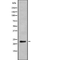 Invitrogen Granzyme H Polyclonal Antibody 100 &mu;L; Unconjugated:Antibodies,
