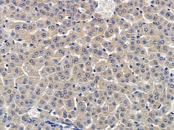 Invitrogen HABP2 Polyclonal Antibody 100 &mu;L; Unconjugated:Antibodies,